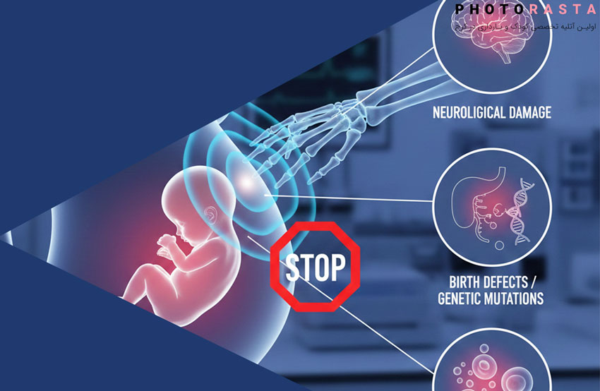 خطرات اشعه ایکس برای زنان باردار: راهنمای جامع ایمنی و نکات حیاتی برای مادران و خانواده